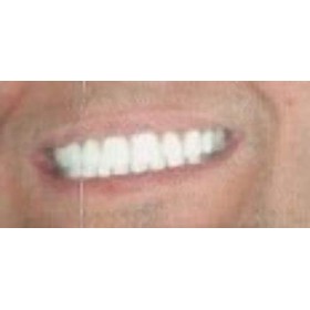 Mehron make-up Tooth FX - White 4 ml 