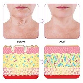 Anti Rides en Silicone 2PCS Anti-Rides en Silicone pour Cou, Poitrine Anti Rides Réutilisable Patchs Coussinets Anti-Rides en