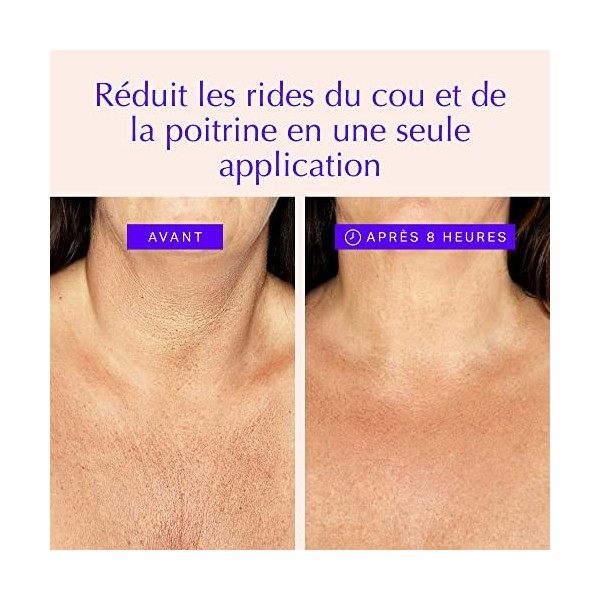 Patchs Anti Rides Réutilisables Pour le Cou et Décolleté - Pour Une Peau Plus Lisse, Jeune & Radieuse - Traitement anti-âge p