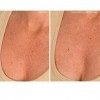 SiO Beauty SkinPad | Chest Anti-Wrinkle Pad 4 Weeks Supply | Overnight Smoothing Silicone Pad For Cleavage & Decollete Skin…