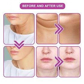 Utapossin Crème pour Le Cou 20ml Crème pour Le Cou Raffermissante Crèmes Hydratantes pour Le Cou Crème de Réduction du Double