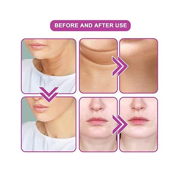 Utapossin Crème pour Le Cou 20ml Crème pour Le Cou Raffermissante Crèmes Hydratantes pour Le Cou Crème de Réduction du Double