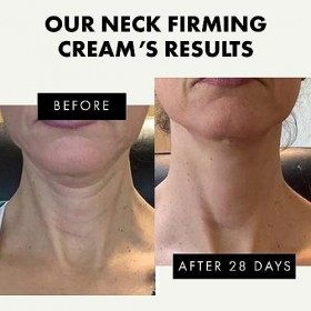 Crème rajeunissante raffermissante pour le cou pour les ridules et les rides, crème raffermissante pour la peau pour femme - 