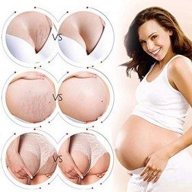 Creme Vergeture, Creme Cicatrice, Stretch Mark Cream, Vergetures Crème Scar, vergetures traitement, réparation de maternité, 