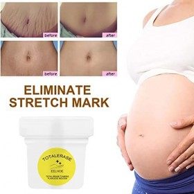 Wukesify Dissolvant de vergetures, 100g Crème Raffermissante sans Défaut Bio, Dissolvant de vergetures et Traitement des Cica