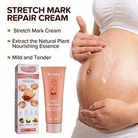 Suppression des vergetures,50ml Crème Nourrissante Vergetures Grossesse | Crème pour le ventre de grossesse idéale, estompe l