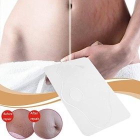 OKUYAN Patch pour vergetures - Patch réutilisable pour enlever les vergetures - Coussinets destomac en silicone anti-rides -