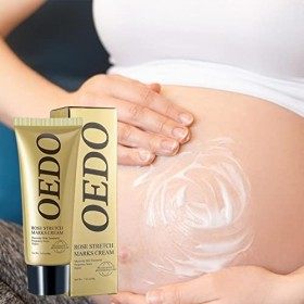 Crème Vergetures,Crème démaquillante et Lotion hydratante | Prévient et réduit lapparence des vergetures, Soins de la Peau d