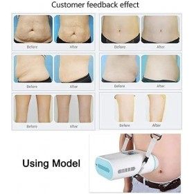 Système De Congélation Pour Sculpter Le Corps, Machine De Cryolipolyse Traitement Par Le Froid Non Invasif Pour Réduire Lapp