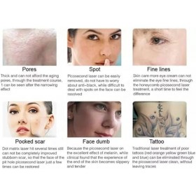 GURSAC Machine de retrait de tatouage au laser, appareil de retrait de tatouage, sourcils, tatouage, lèvres, tatouage, yeux, 