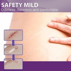 Bande Cicatricielle, Feuilles Résultant de Cicatrices Faciles à Nettoyer, Améliorent lélasticité de la Peau pour les Cliniqu