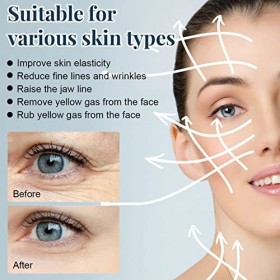 Ensemble de Levage de Fil de Protéine, Hydrater les Rides Supprimer les Soins de la Peau Fil de Protéine de Visage Fil de Pro