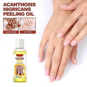 Idezek Ancienne Huile de Gommage Jaune,Taches Naturelles Whiten Yellow Peeling Oil - 110 ML dhuile de Peeling Jaune, Huile d