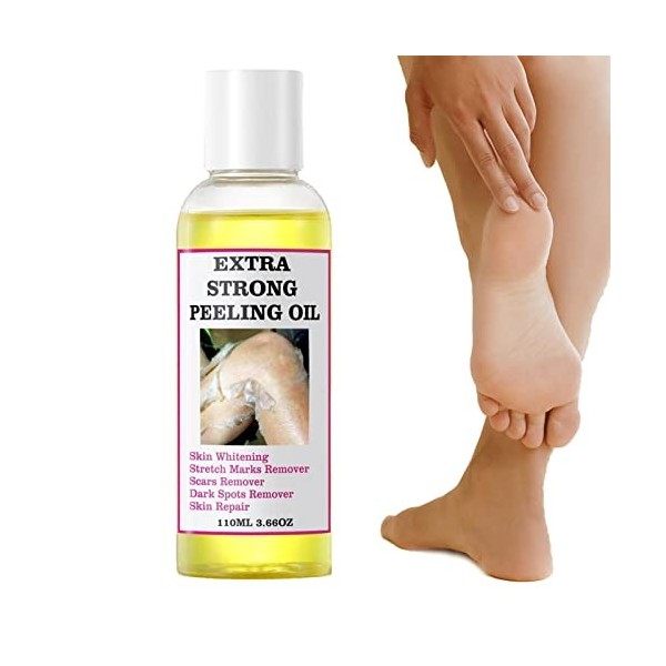 Lotion Peeling Jaune Orange, Huile Peeling Pour Le Corps, Huile De Peeling Jaune Sûre Extra Forte, Lotion De Solution Exfolia