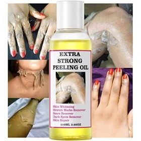 Lotion Peeling Jaune Orange, Huile Peeling Pour Le Corps, Huile De Peeling Jaune Sûre Extra Forte, Lotion De Solution Exfolia