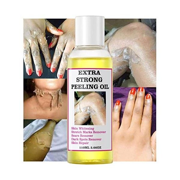 Lotion Peeling Jaune Orange, Huile Peeling Pour Le Corps, Huile De Peeling Jaune Sûre Extra Forte, Lotion De Solution Exfolia