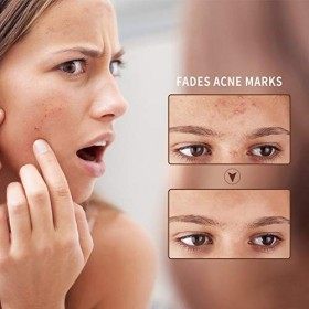 Gel apaisant à laloe vera, 100% naturel pour le visage, le corps, les cheveux, hydratant pour le visage, hydratants après so