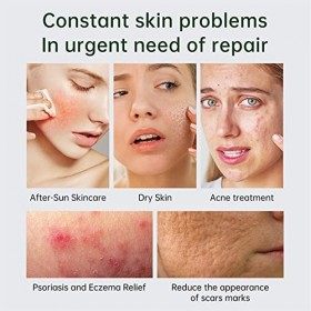 5 Pcs Gel-Crème Aloe Vera | Gel Aloe Vera hydratant apaisant,Crème à lès pour Peaux sèches, Coups de Soleil, hydratant apais