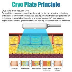 Masseur Portable EMS Cryo Plates Machine Cryolipolyse Machine congélation Graisse à 4 poignées pour lélimination Cellulite G