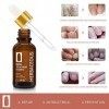 Traitement Des Ongles 30ML Traitement de lOngle Mycosé Soin Mycose Ongles des Pieds Champignons Des Ongles Promotion De La R