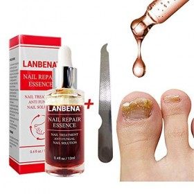 Beito 1PC Nail Repairs Solution de renouvellement des ongles à lhuile essentielle tue les ongles fongiques Traitement fongiq
