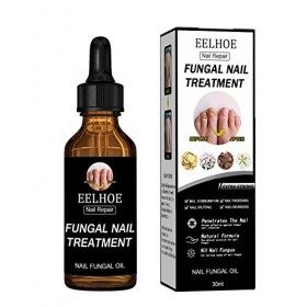 Gusengo 30ml Ongles des Pieds - Traitement Ongle Pied, Nail Treatments Repair Gel, Traitement Ongles, Crème Réparatrice des O