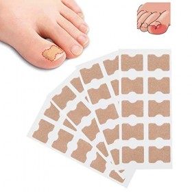 Patch De Bâton Dongle Incarné, Autocollant de correction des ongles, Correction Ongles Incarnés,Correcteur De Paronychie Soi