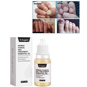 Fongique Nail Repair Essence Serum Toe Nail Fungus Traitement Ongles Gel Pieds Cuticules Huile Nail Repair Fungus Removal Ant