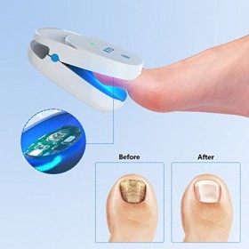KTS Appareil de traitement rechargeable pour lonychomycose, luminothérapie très efficace pour le nettoyage des ongles
