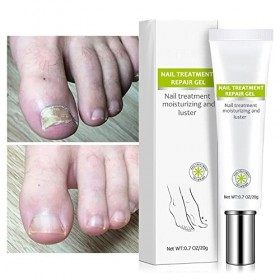 Efero Nail Treatment Repair Gel, Traitement fongique des ongles des orteils et des ongles, Crème réparatrice des ongles, Reno