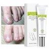 Efero Nail Treatment Repair Gel, Traitement fongique des ongles des orteils et des ongles, Crème réparatrice des ongles, Reno