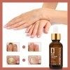 Solution de traitement fongique pour ongles de 30 ml avec coupeongles en acier inoxydable, antichampignons pour ongles des or