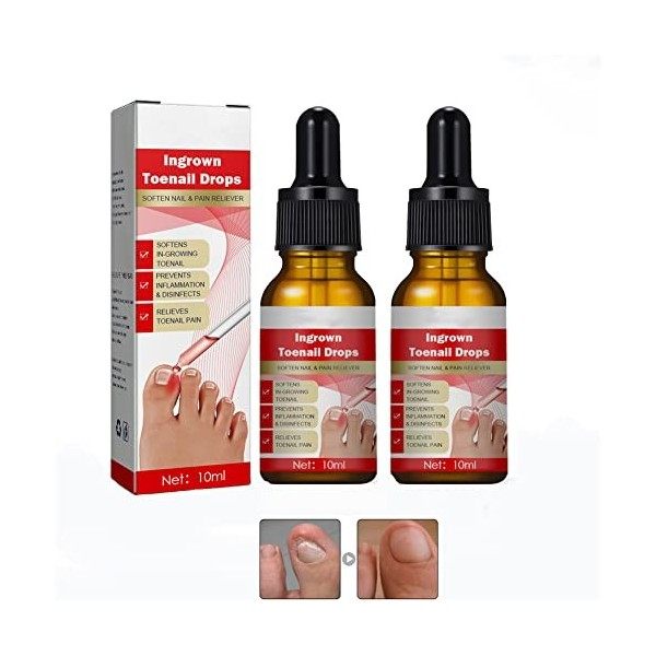 Huile De Traitement De Correction Des Ongles Des Pieds, Soin Des Ongles Et Des Cuticules, Ramollissant Des Ongles Des Pieds P