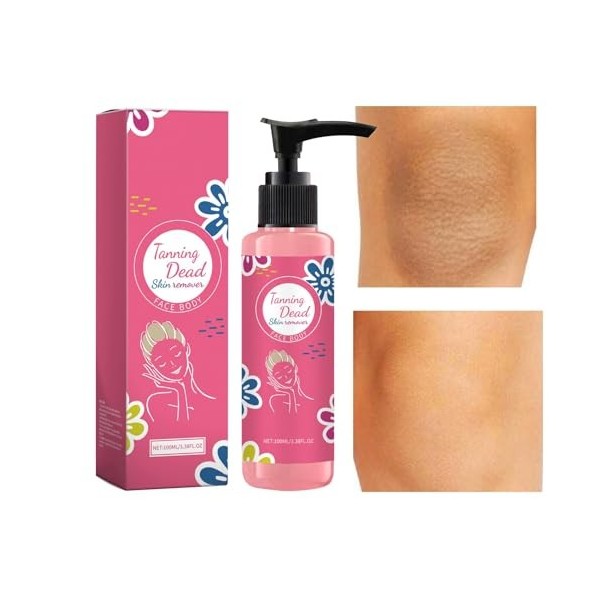 Gel dissolvant de pour la peau - 3,38 oz Produits de soins de la peau éclaircissants | Gel nettoyant pour le corps réparation