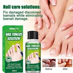 Essence de réparation des ongles - Grey Nail Solution Nail Repair pour les ongles abîmés | Liquide de soin des pieds pour ong