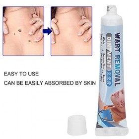 Crème Anti-verrues 20g, Anti-verrues Faciales, Pommade Anti-verrues Plantaires Adoucissante pour les Pieds du Visage