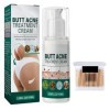 Crème Pour Les Boutons Des Fesses,Crème Délimination des Boutons des Fesses,Crème de Traitement de Lacné des Hanches,Répara