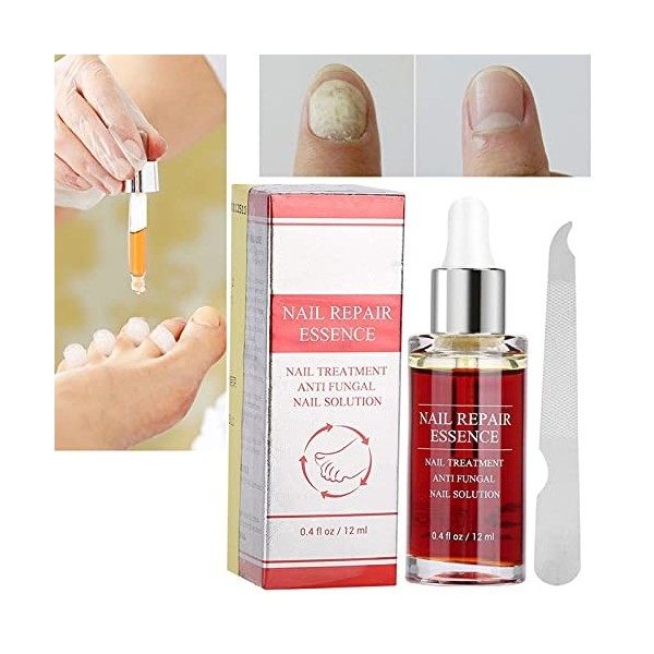 15 ML Naturel Puissant Réparation des Ongles Essence Anti-fongique Traitement des Ongles Solution de Réparation Efficace Lanb