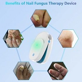 iKeener Dispositif Traitement Champignons Ongles,Approuvé FDA Laser Thérapie Nettoyage dentretien Ongle équipement,Soins Mai