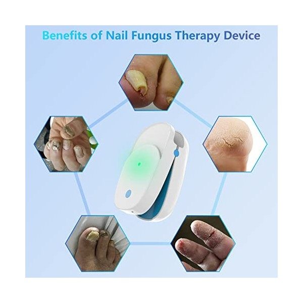 iKeener Dispositif Traitement Champignons Ongles,Approuvé FDA Laser Thérapie Nettoyage dentretien Ongle équipement,Soins Mai