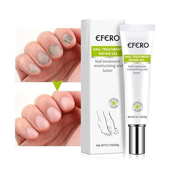 Sérum de traitement des ongles fongique, gel délimination des champignons, infection des ongles, crème de soin pour lonycho