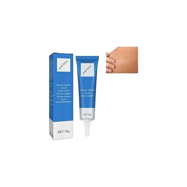 Crème Anti-Cicatrices pour le Visage,Gel Pour Traitement Des Cicatrices Excessives,Gel Pour Cicatrices,Crème Eliminer Nouvell