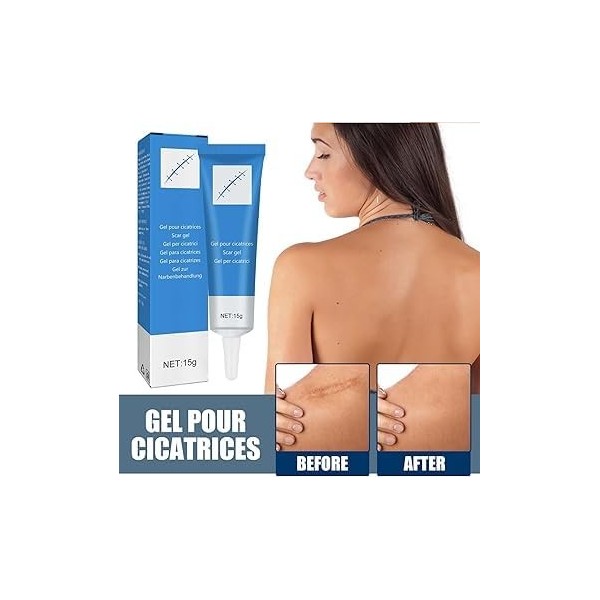 Crème Anti-Cicatrices pour le Visage,Gel Pour Traitement Des Cicatrices Excessives,Gel Pour Cicatrices,Crème Eliminer Nouvell