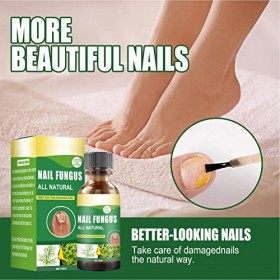 Traitement Fongique des Ongles, Huile de Soin des Ongles à Forte Perméabilité, Matériau Naturel Doux et Sûr, Liquide de Répar