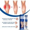 Varicose Veins Cream, 2 Pièces Varices Crème, Varices Jambes Crème, Varices Traitement Jambes Crème, Crème pour les Varices, 