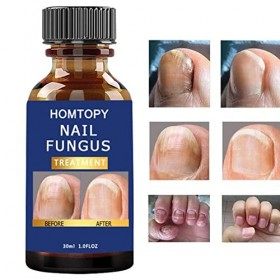 Rubeyul Durcisseur dongles - Renforcement des Ongles pour Les Ongles Fins et la Croissance,Patchs pour Ongles Anti-fongiques