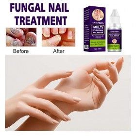 Essence De Réparation Des Ongles, Huile De Soin Des Ongles - 10 Ml De Solution Pour Les Ongles Et Les Ongles Des Pieds Fongiq