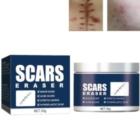 Creme Anti Vergeture,Crème pour la Réparation des Cicatrices,Crème Pour éliminer les Cicatrices,Crème Cicatrice pour Visage,C