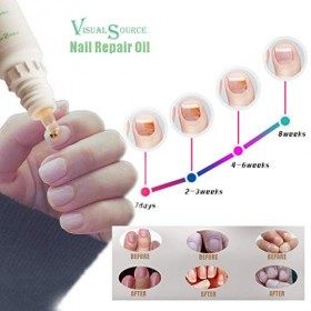 Bethyall Lit Complet Ongle Stylo à Ongles Liquide de réparation Onychomycosis NAI Anti Traitement Paronychia 10ML fongique Po