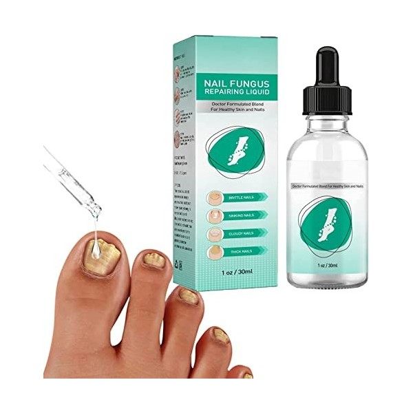 Kerassentials Huile de traitement fongique pour ongles dorteils, Kerassentials pour les pieds, traitement des ongles Kerasen